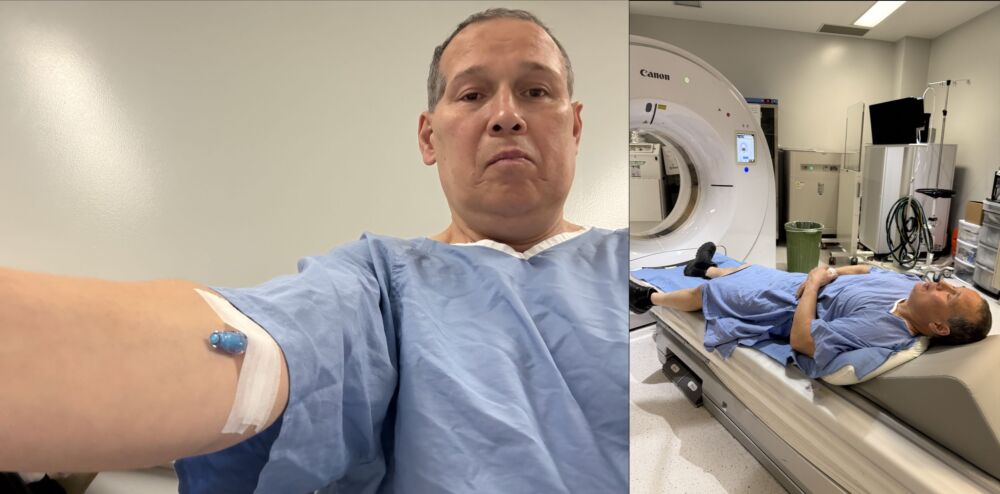 CT Scan